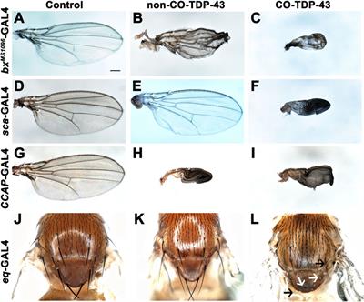 Codon-optimized TDP-43 mediates neurodegeneration in a Drosophila model of ALS/FTLD